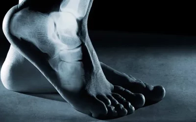 Qu’est-ce que le Foot Core ?